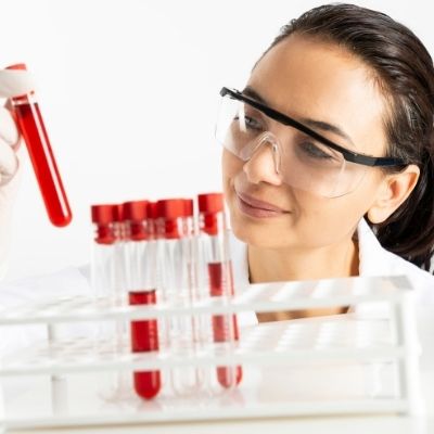 Pajzsmirigy vizsgálat SMSMILE LAB